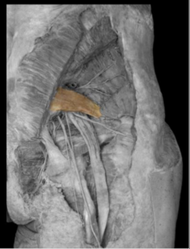 <p>Piriformis </p>