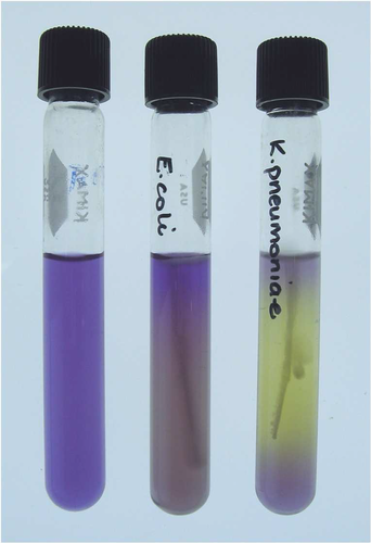 <p>Ornithine decarboxylase</p>