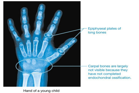 <p>Articular cartilage persists into adulthood; epiphyseal plates are eventually replaced with bone, once growth in length ceases</p>