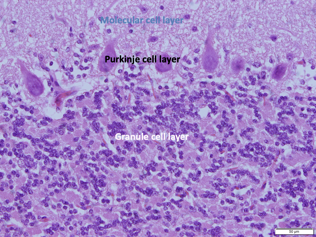 <p>Have white matter in the center, but gray matter surrounding it… from innermost to outermost:</p><ul><li><p><strong>Granule cell layer</strong></p></li><li><p><strong>Purkinje cell layer</strong></p></li><li><p><strong>Molecular cell layer </strong></p></li></ul><p></p>