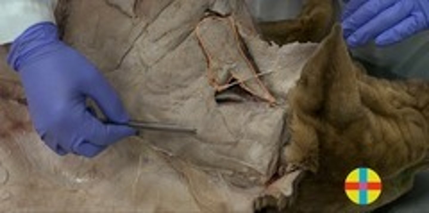 <p>Origen: Ala del atlas/apófisis transversa C2</p><p>Inserción: Espina escápula</p><p>Función: flexión y lateralización del cuello o, también puede desplazar hacia craneal la escápula (anteversor)</p><p>Inervación: N. accesorio.</p>