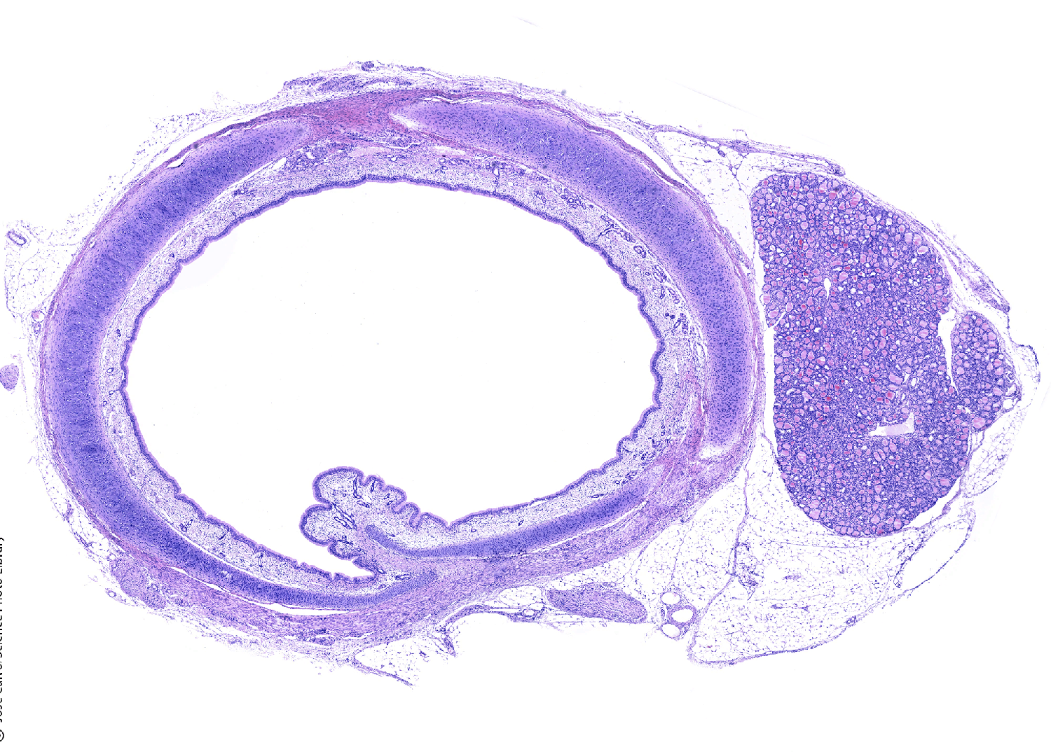 <p>List the layers of the Trachea </p>