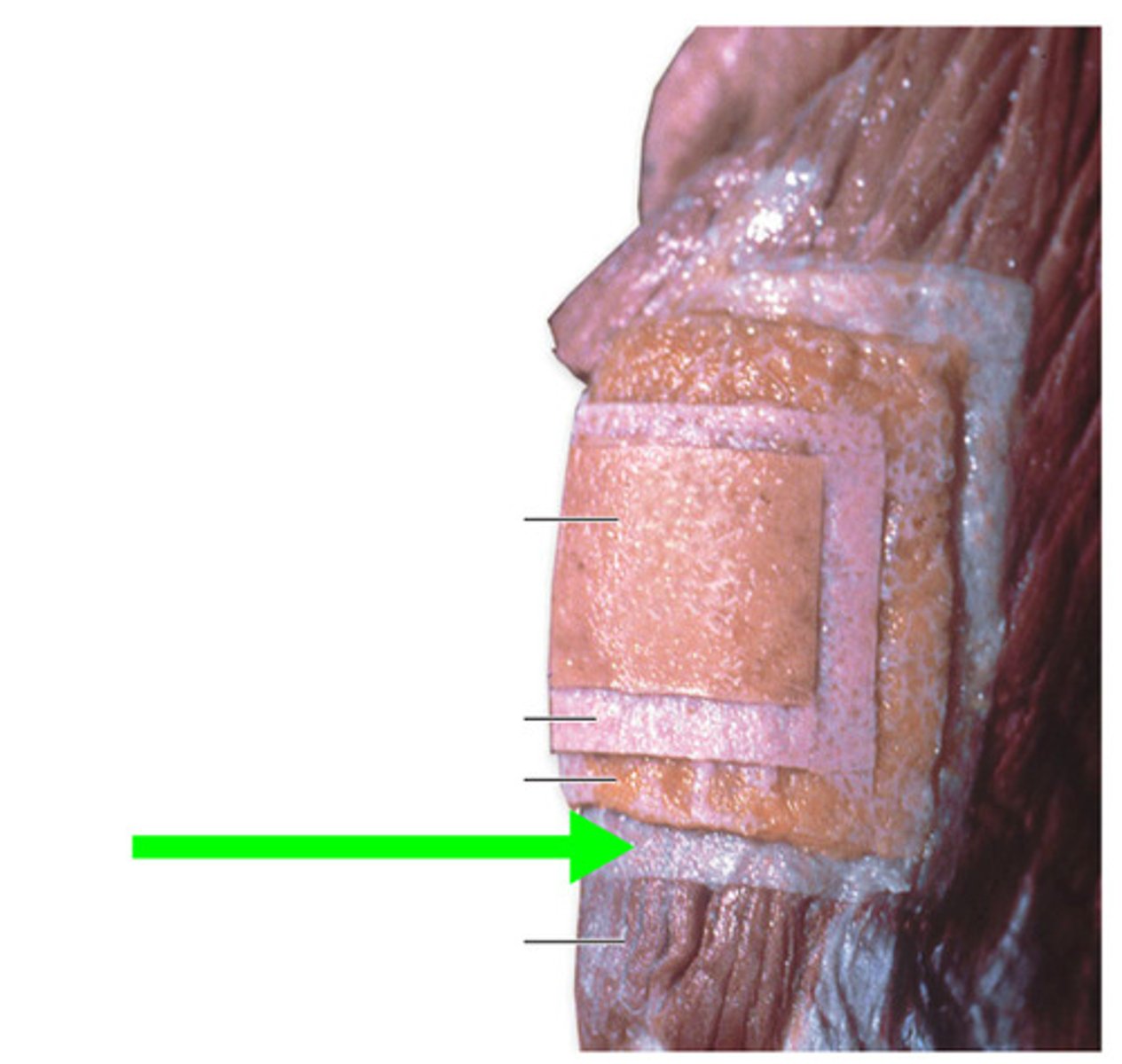 <p>dense irregular connective tissue around muscle</p>