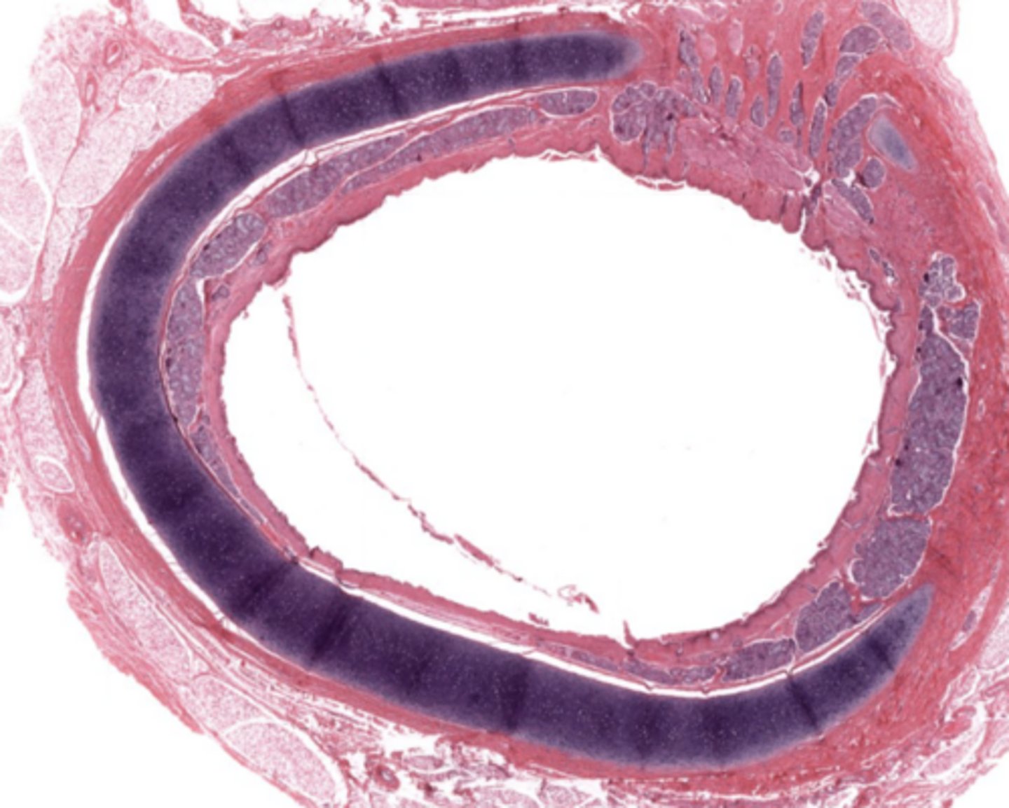<p>Mucosa, submucosa, cartilaginous layer, adventitia.</p>