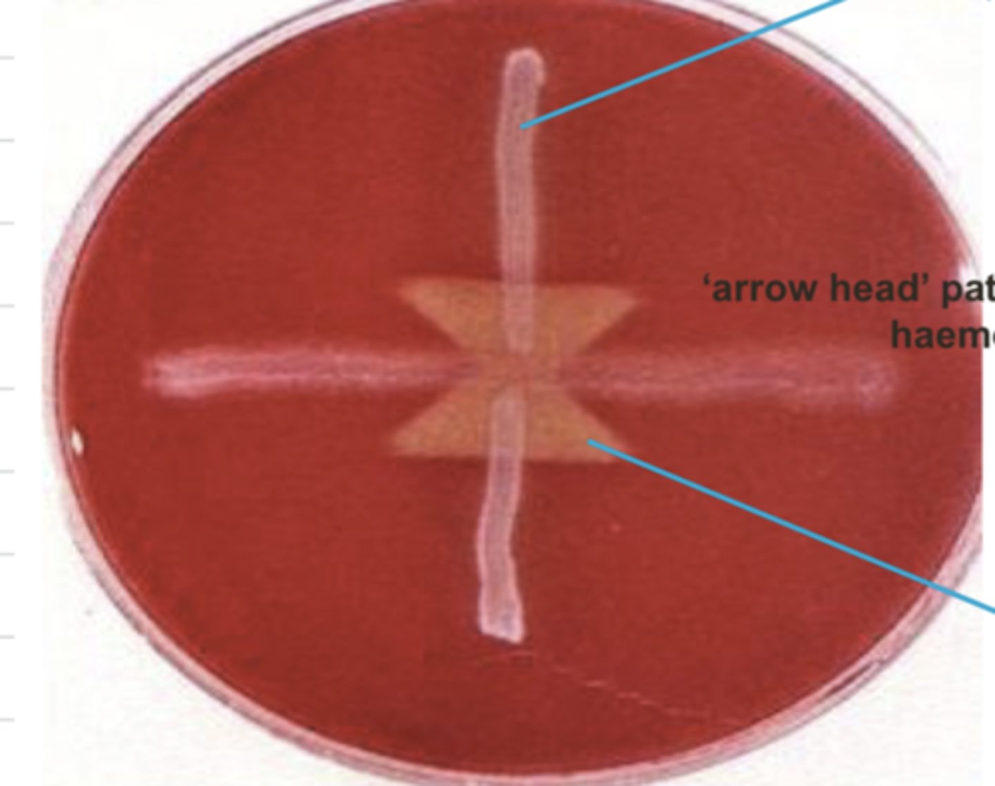 <p>what bacteria caused the arrowhead shape?</p>