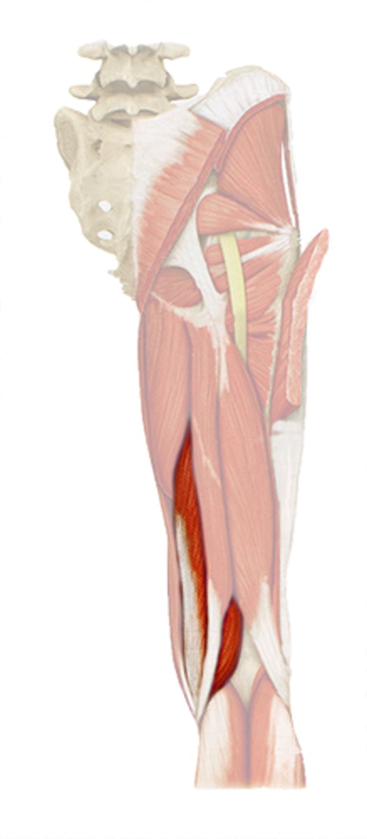 <p>flexes knee, extends hip</p>