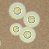 <p><span style="color: rgb(40, 16, 203);"><u>India ink</u> stains <strong><em>Cryptococcus neoformans</em></strong> in <strong>CSF</strong></span></p><ul><li><p><em>C. neoformans</em> has visible <strong>“Halo” </strong>= <strong>thick capsule</strong> lacks india ink surrounding fungi</p></li></ul><p></p>