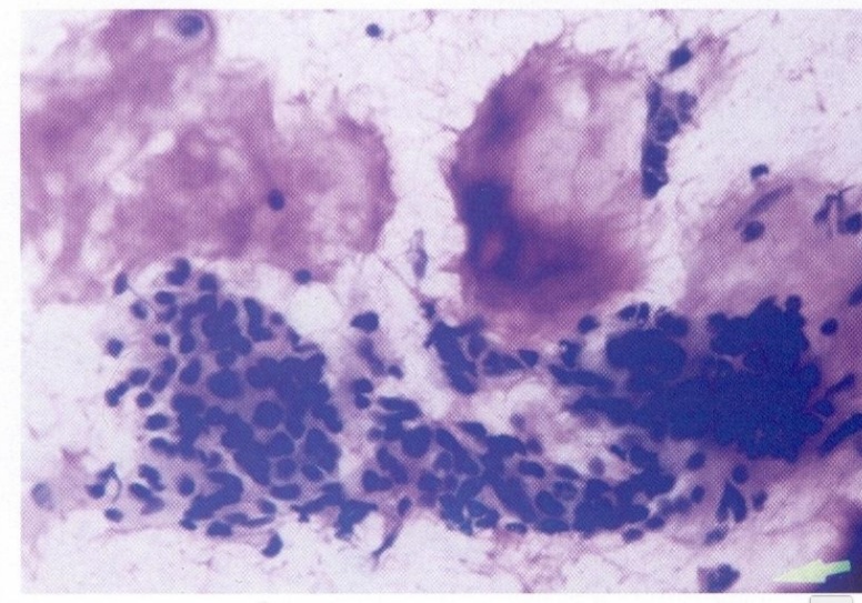term image