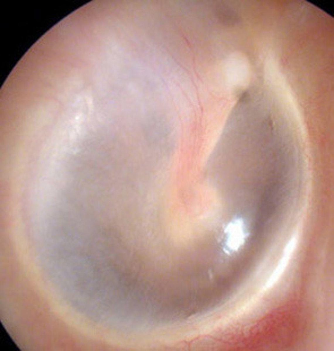 <p>- very thin</p><p>- almost transparent</p>