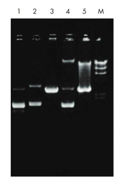 <p>describe what plasmid structure is in each lane</p>