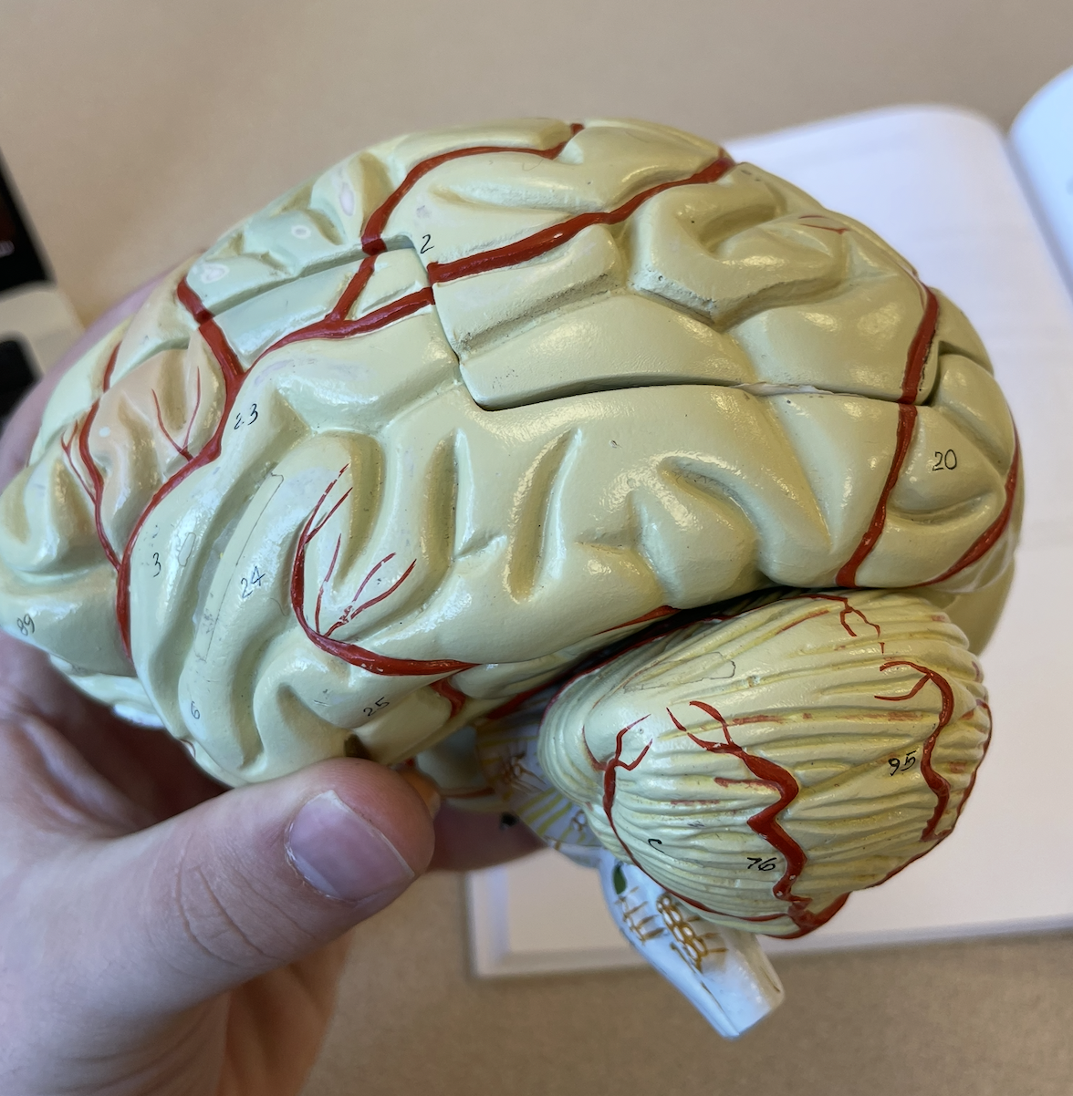 <p>76/95 (large structure)</p>