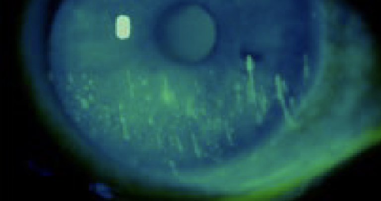 term image