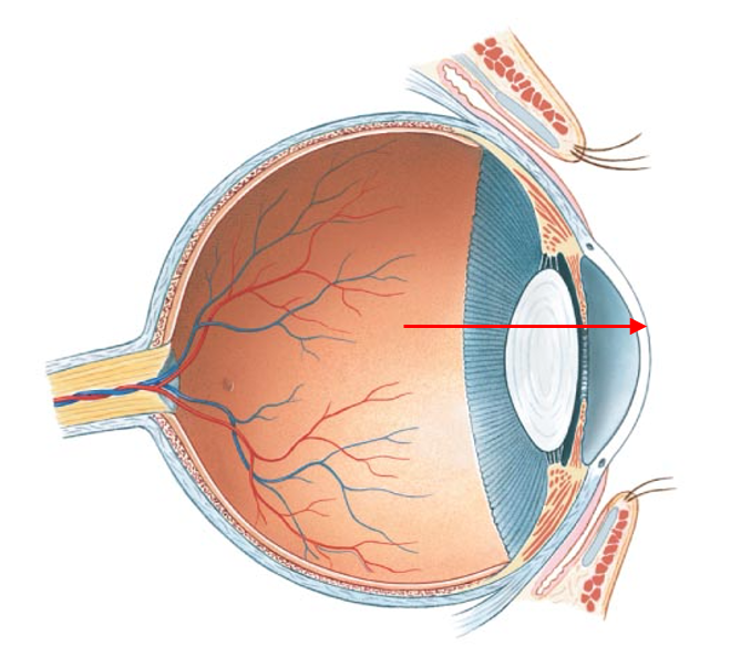 term image