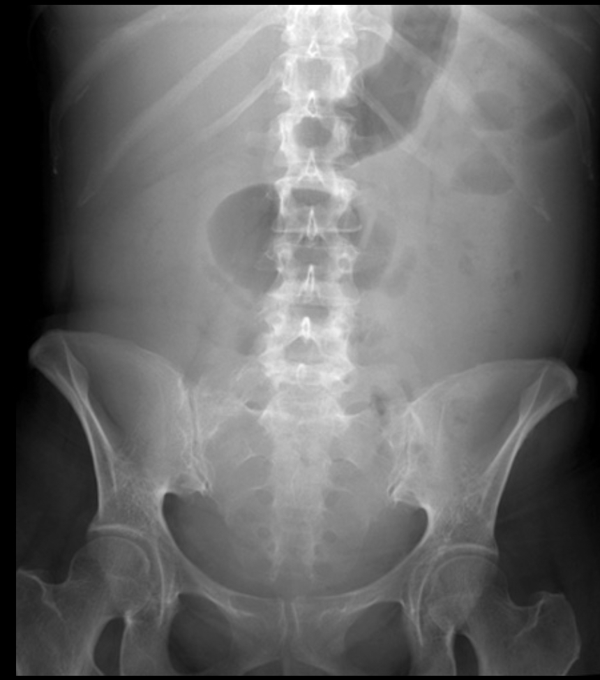<p>What pathology is this?</p>