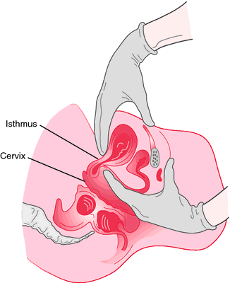 <p>characterized by the compressibility and softening of the cervical isthmus (i.e., the portion of the cervix between the uterus and the vaginal portion of the cervix).</p>