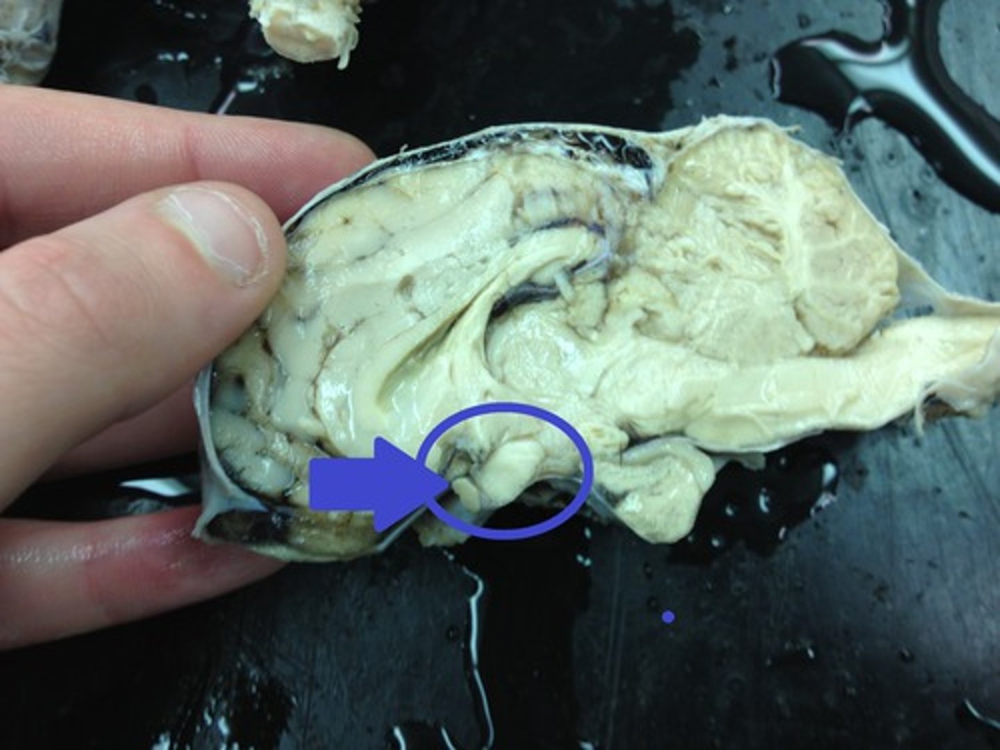 <p>the crossing of the optic nerves from the two eyes at the base of the brain</p>