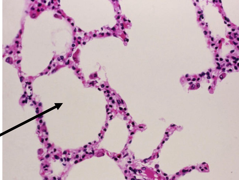<p>Identify the type of tissue and the<br>structure at the arrow</p>