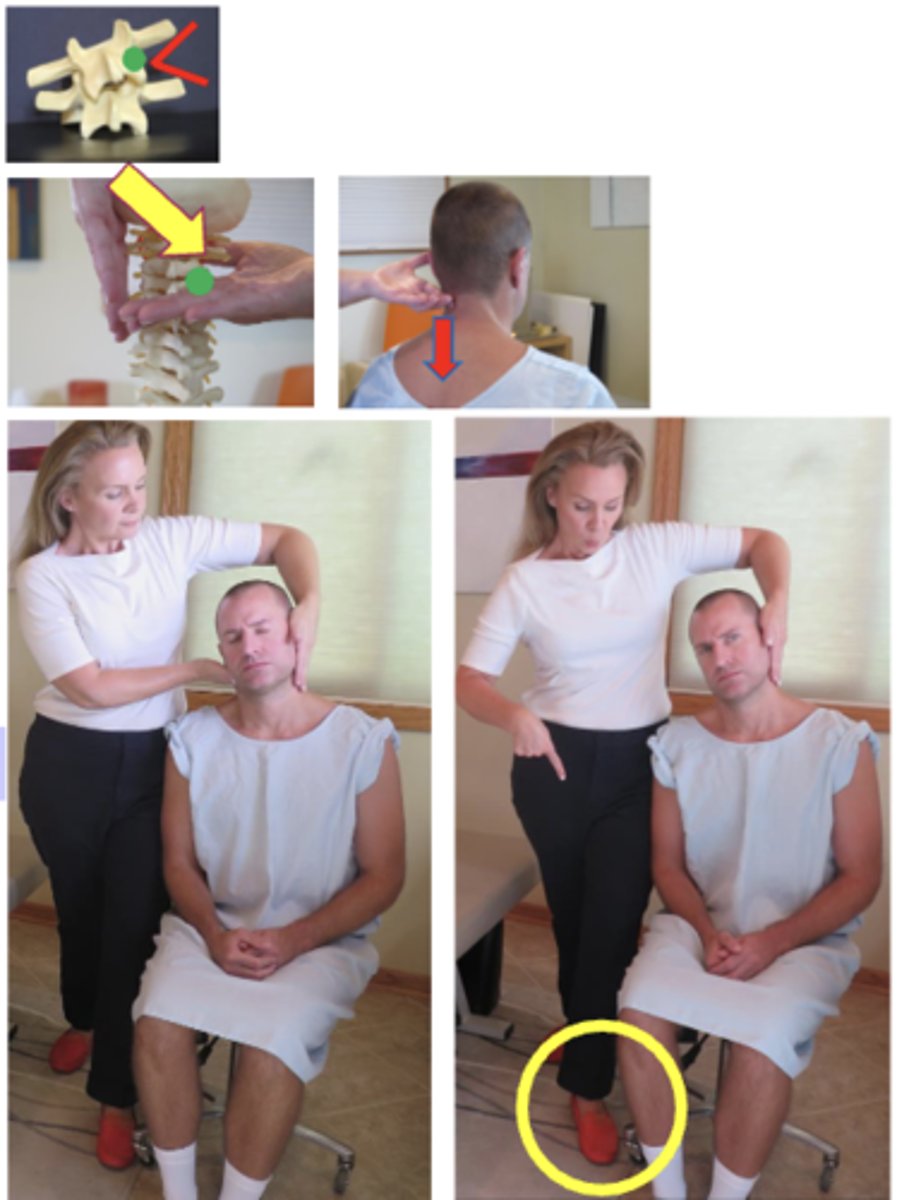 <p>• PP: Seated in a chair with back, asks permission to open gown/contact patient, verbalize finding the segment</p><p>• DP: Stands behind patient, same side as contact, doctor has leg OPPOSITE of contact hand forward, tissue slack S-I</p><p>• CH: 2nd digit on articular pillar of superior segment of contact, palm up, THUMB resting on patient's cheek</p><p>• IH: Indifferent hand #1, Elbow up and forearm pointing down, fingers pointing down, stabilize opposite occiput &amp; cheek</p><p>• VEC: L-M for lateral flexion malposition (close the wedge)</p><p>**P-A w/ clockwise or counterclockwise torque for rotationmalposition</p>