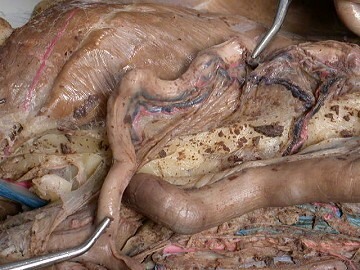 -Where each oviduct merges
-The right and left horns join in the midline to form the main uterine tube
-Part of the Female Reproduction Tract