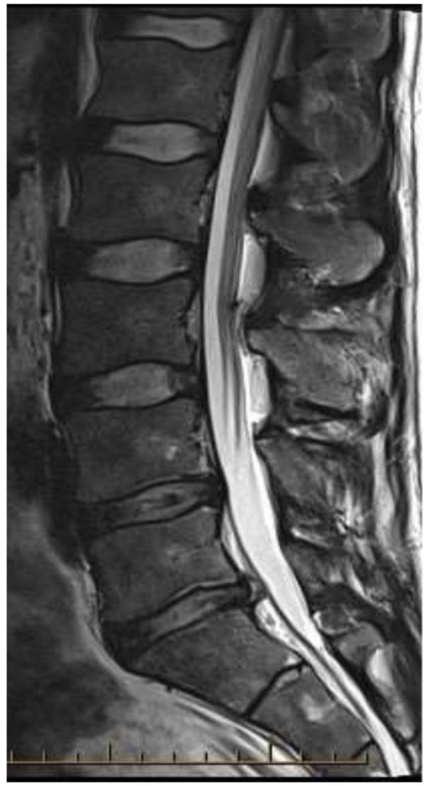 <p>What is the image weighting of this slice?</p>