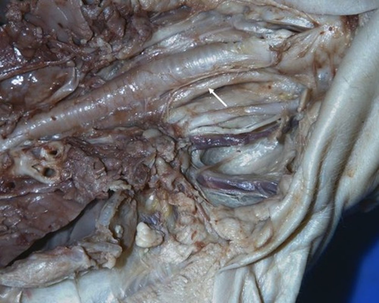 <p>muscular tube that connects the mouth to the stomach.</p>