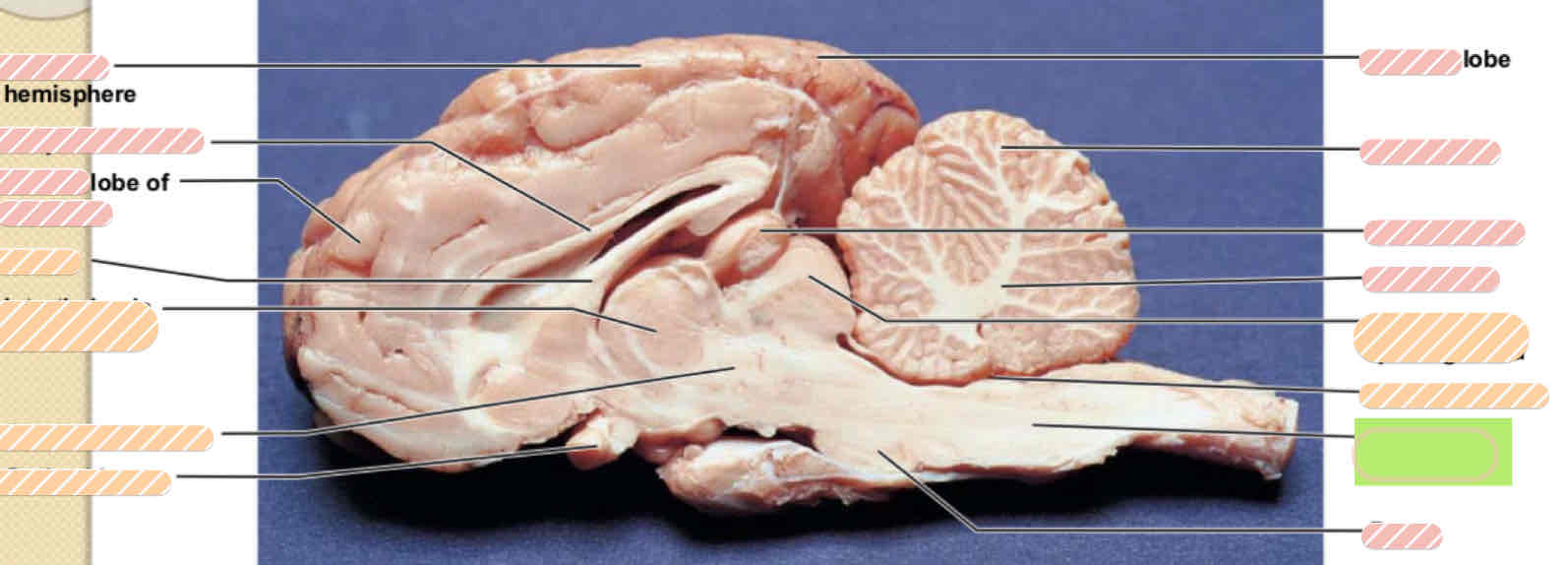 <p><span>Sheep brain</span></p>