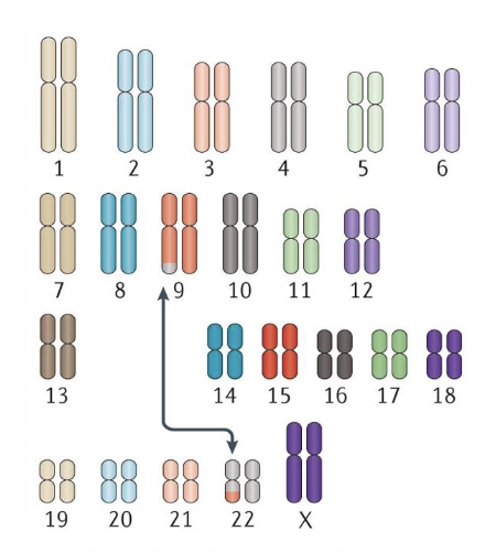 <p>An abnormal chromosome region that contains <strong>rearranged genetic material</strong>, usually from two non-homologous chromosomes</p>