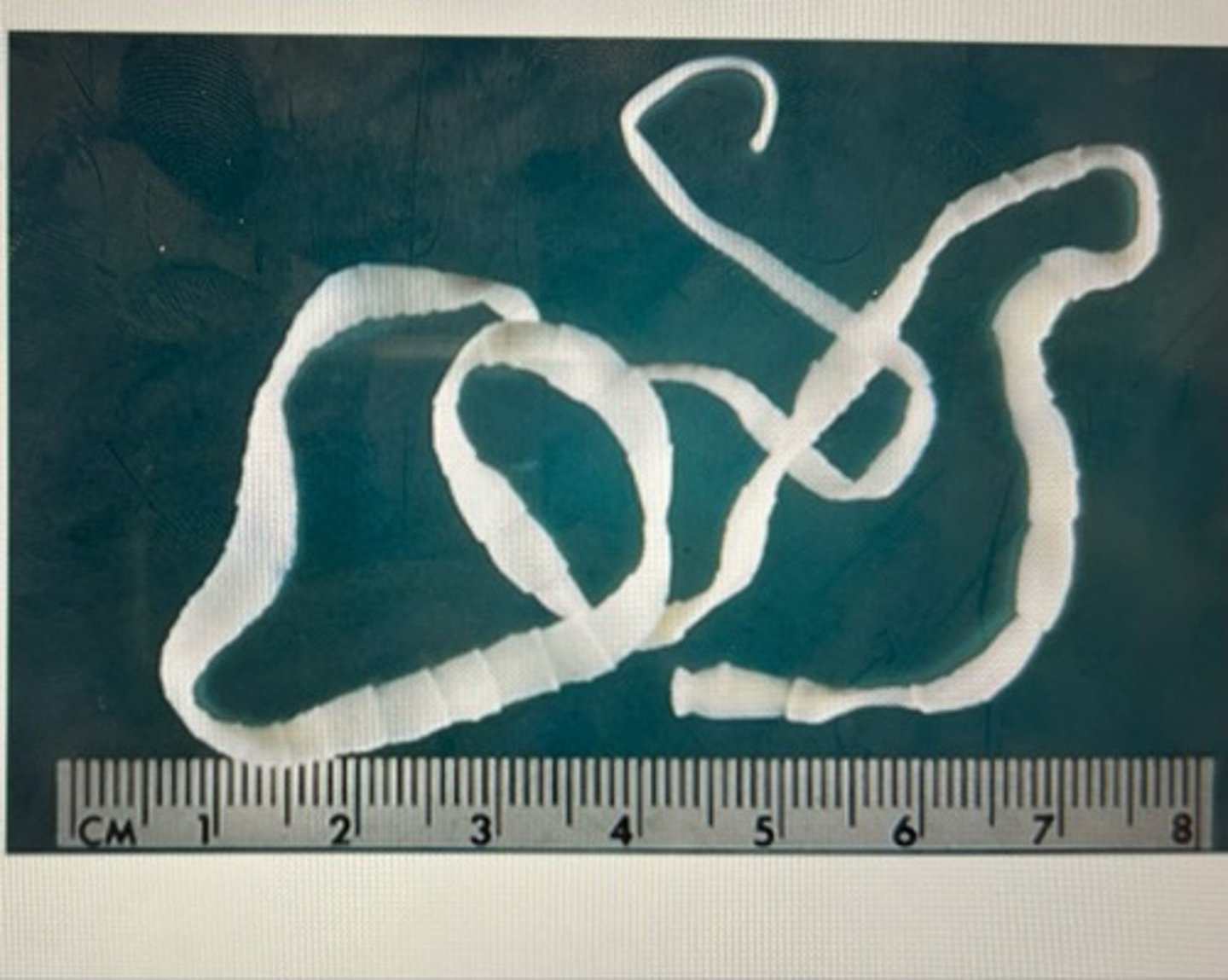 <p>This parasite is a</p>