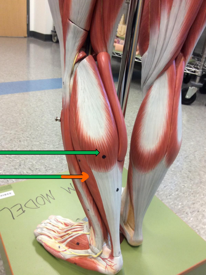 <p>Identify this muscle?</p>