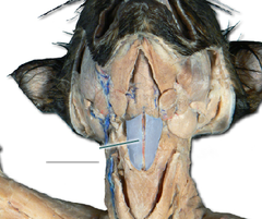 <p>anterior neck muscle, two stripes, Depresses hyoid during speech and swallowing</p>