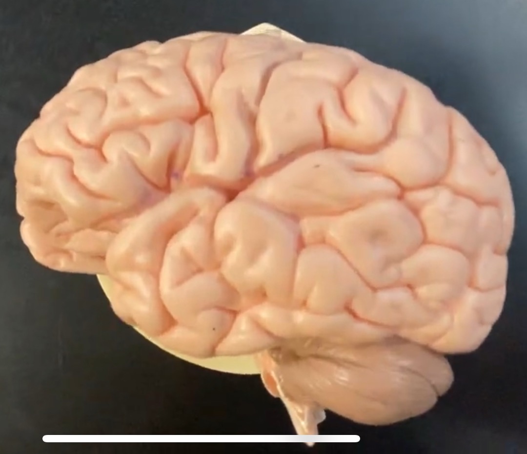 <p>central sulcus</p>