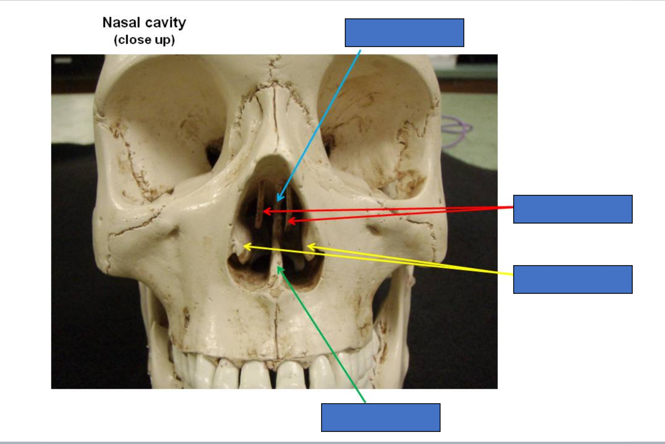 <p>Perpendicular plate of the thmoid</p>