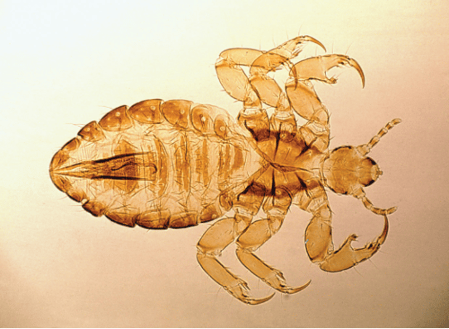 <p>have six legs, have claws and are found in head hair</p>