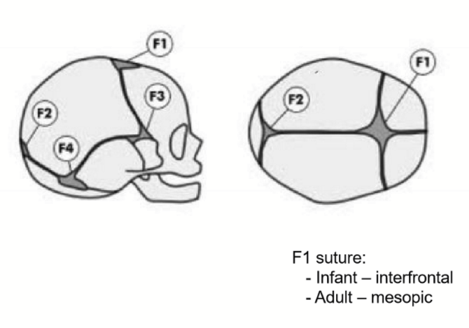 <p>- Anterior (F1)<br>- Posterior (F2)<br>- Sphenoidal or anterolateral (F3) [paired]<br>- Mastoid or posterolateral (F4) [paired]</p>