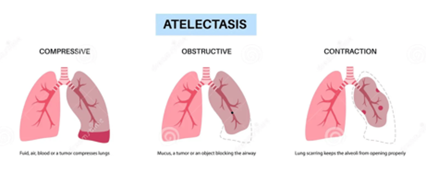 <p>- Loss of lung capacity</p><p>- Altered gas exchange</p><p>- Increase in closing volumes of small airways, predisposed to atelectasis and risk of pneumonia</p><p>- Diaphragmatic strength declines</p><p>- Mild decrease in arterial pO2 but O2 saturation normally remains above 90%</p><p>- Skeletal change, accentuate dorsal curve of the thoracic spine (kyphosis)</p>
