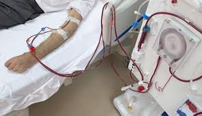 <p><strong>A 42-year-old male has been diagnosed with renal failure secondary to diabetes mellitus and is scheduled to begin dialysis soon. Which of the following statements by the client reflects an accurate understanding of the process of hemodialysis?</strong></p><p>A) “It's stressful knowing that committing to dialysis means I can't qualify for a kidney transplant.”</p><p>B) “I know I'll have to go to a hospital or dialysis center for treatment.”</p><p>C) “Changing my schedule to accommodate 3 or 4 hours of hemodialysis each day will be difficult.”</p><p>D) “I won't be able to go about my normal routine during treatment.” </p>