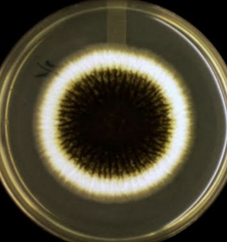 <p>what microbe</p><p>what agar?</p>