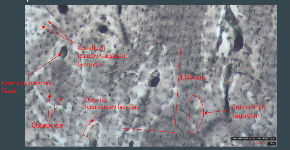 <ul><li><p>osteocyte </p></li><li><p>osteon</p></li><li><p>central haversian canal</p></li><li><p>canaliculi </p></li><li><p>interstitial lamellae</p></li><li><p>osteonic concentric lamellae </p><p></p></li></ul><p></p>