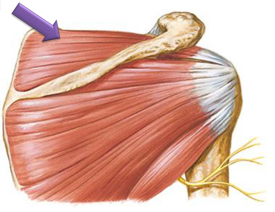 <p>Supraspinatus (RTC)</p>
