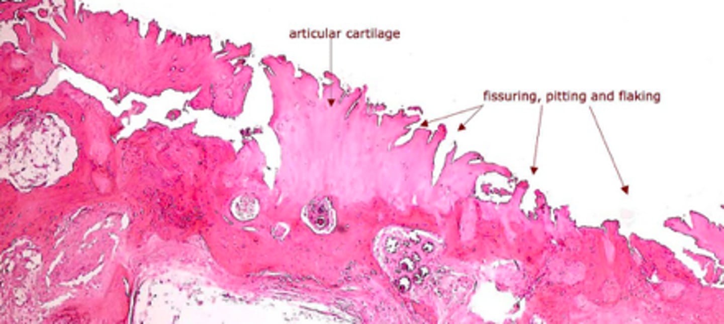 <p>identify the cartilage disease:</p>