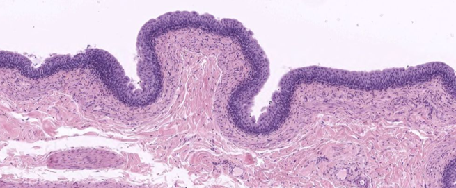<ul><li><p>Transitional epithelium</p></li><li><p>Lamina propria</p></li><li><p>Smooth muscle - longitudinal</p></li><li><p>Smooth muscle - circular</p></li><li><p>Smooth muscle - longitudinal</p></li></ul><p></p>