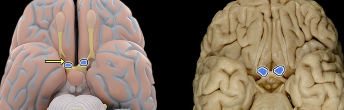 <p>Optic n. CN II</p>