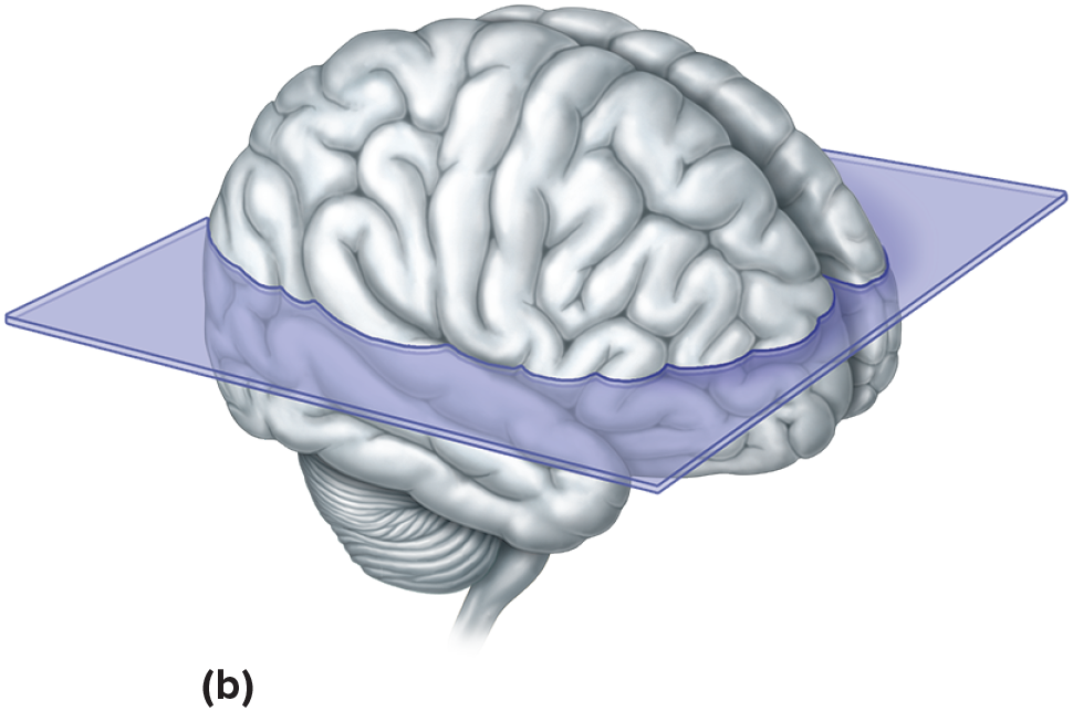 <p>horizontal cute that divides the body into superior and inferior portions.</p>