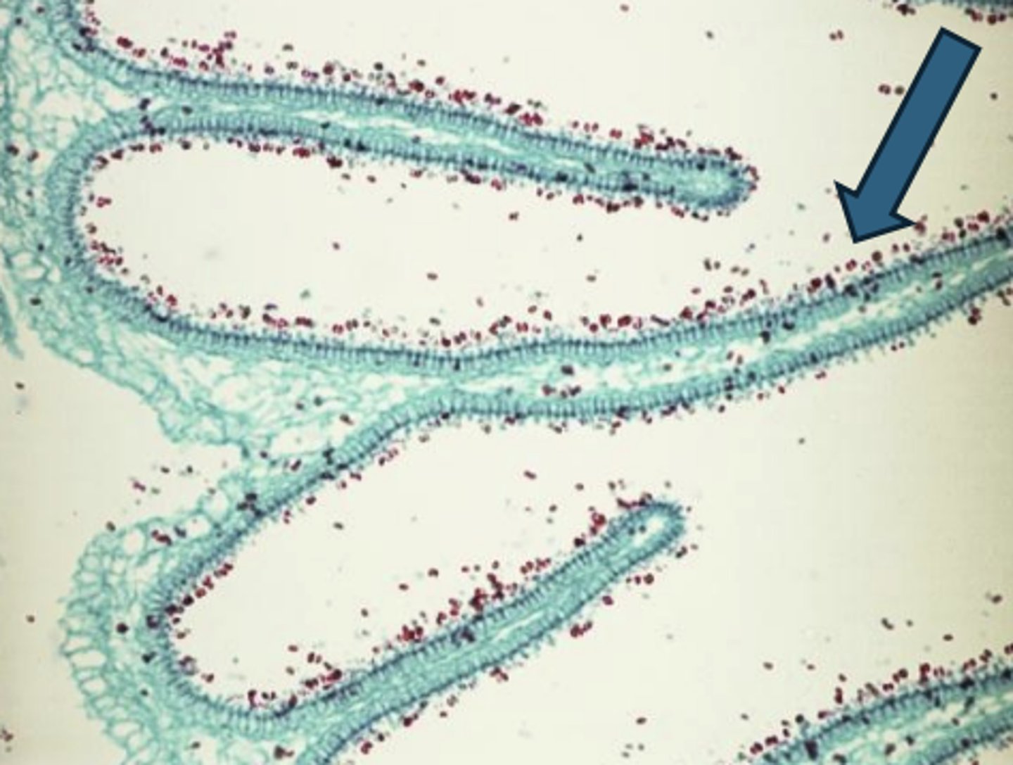 <p>basidiospore; sexual</p>