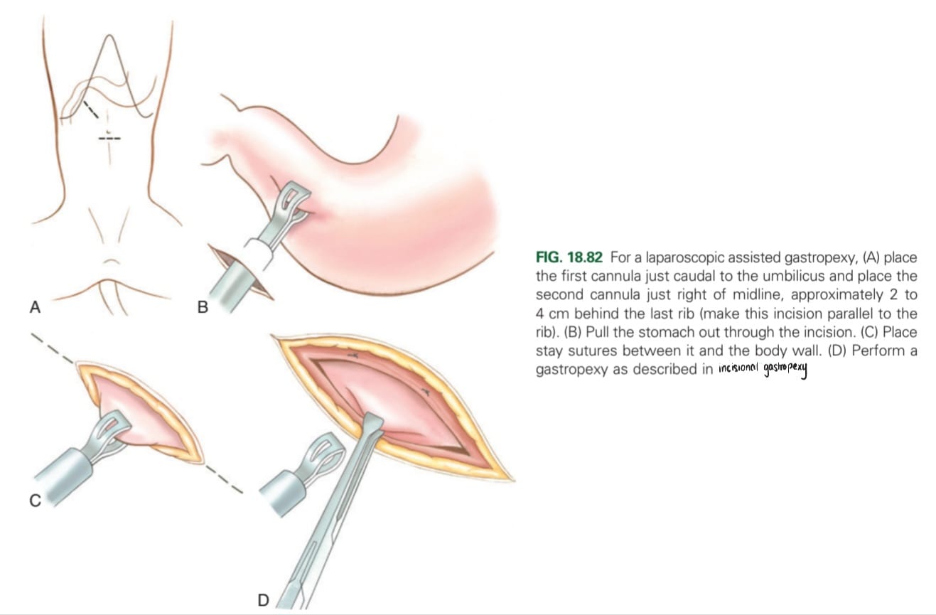 <p>Paracostal or midline.</p>