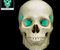 <p>forms part of the base of the skull and parts of the floor and sides of the orbit</p>