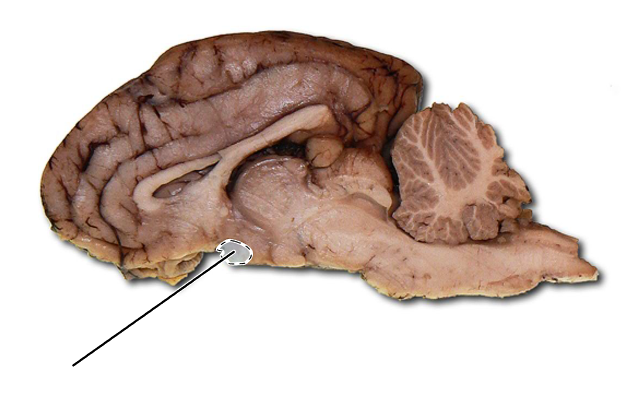 <p>Name the part of the brain that is highlighted.</p>