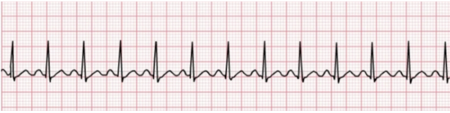 <p>Identify the rhythm! Discuss nursing and collaborative care</p>