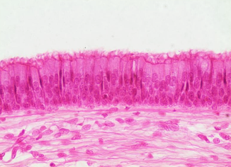<p>What type of tissue is this? </p>
