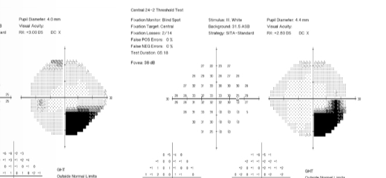 <p>What is this VF plot showing</p>